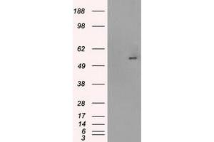 Western Blotting (WB) image for anti-Solute Carrier Family 2 (Facilitated Glucose/fructose Transporter), Member 5 (SLC2A5) antibody (ABIN2721986)