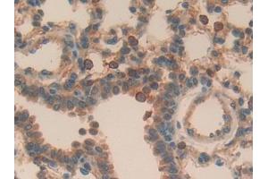 Detection of APOH in Mouse Lung Tissue using Polyclonal Antibody to Apolipoprotein H (APOH) (APOH 抗体  (AA 21-345))