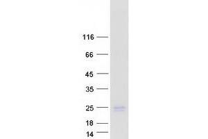 Western Blotting (WB) image for Hematological and Neurological Expressed 1 (HN1) (Transcript Variant 3) protein (Myc-DYKDDDDK Tag) (ABIN2722889)