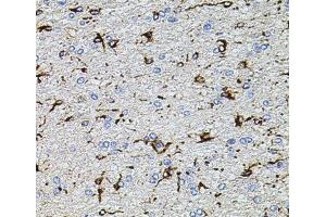 Immunohistochemistry of paraffin-embedded Rat brain using TRPA1 Polyclonal Antibody at dilution of 1:100 (40x lens). (TRPA1 抗体)