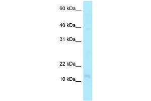 WB Suggested Anti-PFDN4 Antibody Titration: 1. (PFDN4 抗体  (N-Term))