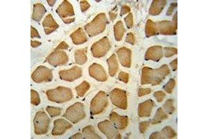 NPEPPS antibody IHC analysis in formalin fixed and paraffin embedded human skeletal muscle. (NPEPPS 抗体  (AA 709-737))