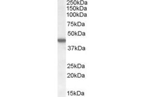 ABIN238540 (1µg/ml) staining of HEK293 cell lysate (35µg protein in RIPA buffer). (CK1 epsilon 抗体  (C-Term))