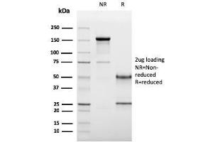 SDS-PAGE Analysis Purified CD19 Monospecific Mouse Monoclonal Antibody (CD19/3117). (CD19 抗体  (AA 96-281))