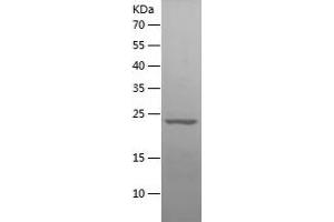 Western Blotting (WB) image for Interleukin 6 (IL6) (AA 47-241) protein (His tag) (ABIN7123604)