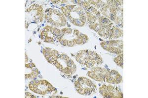 Immunohistochemistry of paraffin-embedded human stomach using VEPH1 antibody (ABIN5974616) (40x lens). (VEPH1 抗体)