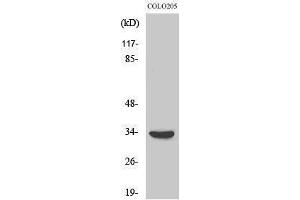 Western Blotting (WB) image for anti-Myeloid Differentiation Primary Response Gene (88) (MYD88) (Internal Region) antibody (ABIN3185721) (MYD88 抗体  (Internal Region))