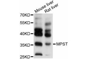 Western blot analysis of extracts of various cell lines, using MPST antibody (ABIN5998252) at 1/1000 dilution. (MPST 抗体)