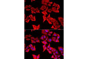 Immunofluorescence analysis of U2OS cells using THRSP antibody (ABIN5974357). (THRSP 抗体)