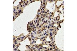 Immunohistochemical analysis of CDK6 staining in rat lung  formalin fixed paraffin embedded tissue section. (CDK6 抗体)
