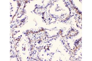 IHC analysis of Integrin alpha 3 using anti-Integrin alpha 3 antibody (ABIN6719410). (ITGA3 抗体)
