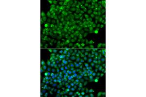 Immunofluorescence analysis of A549 cells using CFHR3 antibody (ABIN6294036). (CFHR3 抗体)