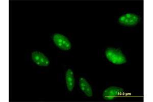 Immunofluorescence of purified MaxPab antibody to C2orf3 on HeLa cell. (GCFC2 抗体  (AA 1-215))