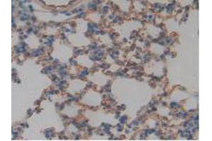 IHC-P analysis of Mouse Lung Tissue, with DAB staining. (Thrombomodulin 抗体  (AA 31-167))