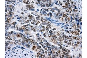 Immunohistochemical staining of paraffin-embedded Kidney tissue using anti-HNRNPFmouse monoclonal antibody. (HNRNPF 抗体)