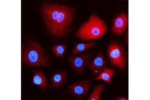 IF analysis of EEA1 using anti- EEA1 antibody (ABIN5692856). (EEA1 抗体)