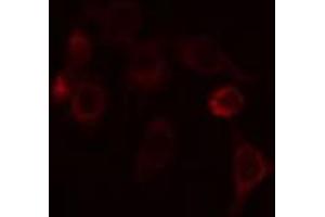 ABIN6274130 staining 293 cells by IF/ICC. (DGKI 抗体  (C-Term))