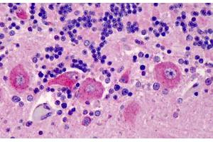 Human  Brain, Cerebellum: Formalin-Fixed, Paraffin-Embedded (FFPE) (GPR77 抗体  (AA 1-50))