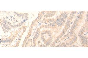 Immunohistochemistry (Paraffin-embedded Sections) (IHC (p)) image for anti-Egf-Like Module Containing, Mucin-Like, Hormone Receptor-Like 3 (EMR3) antibody (ABIN7248557)