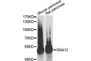 Western blot analysis of extracts of various cell lines, using GNA12 antibody (ABIN6292955) at 1:3000 dilution. (GNA12 抗体)