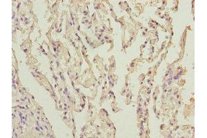 Immunohistochemistry of paraffin-embedded human lung tissue using ABIN7170967 at dilution of 1:100 (UBE2I 抗体  (AA 1-157))