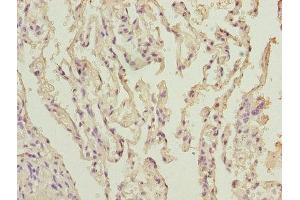 Immunohistochemistry of paraffin-embedded human lung tissue using ABIN7170967 at dilution of 1:100