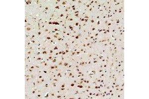 Immunohistochemical analysis of NF-kappaB p65 staining in rat brain  formalin fixed paraffin embedded tissue section. (NF-kB p65 抗体)