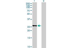 Western Blot analysis of METTL6 expression in transfected 293T cell line by METTL6 MaxPab polyclonal antibody. (METTL6 抗体  (AA 1-255))
