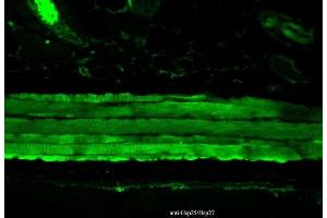 Immunohistochemistry analysis using Mouse Anti-Hsp27 Monoclonal Antibody, Clone 8A7 (ABIN361755 and ABIN361756). (HSP27 抗体)