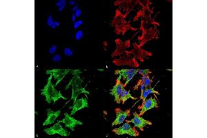 Immunocytochemistry (ICC) image for anti-Glutamate Receptor, Ionotropic, N-Methyl D-Aspartate 1 (GRIN1) (AA 42-361) antibody (ABIN1027724)