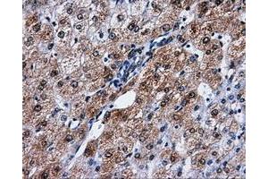 Immunohistochemical staining of paraffin-embedded liver tissue using anti-PPME1mouse monoclonal antibody. (PPME1 抗体)