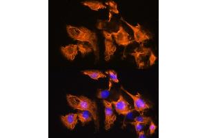 Immunofluorescence analysis of C6 cells using  Rabbit pAb (ABIN7265482) at dilution of 1:100. (ARF4 抗体  (AA 1-180))