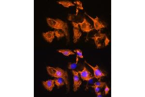 Immunofluorescence analysis of C6 cells using  Rabbit pAb (ABIN7265482) at dilution of 1:100.
