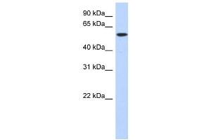 DNTT antibody used at 1 ug/ml to detect target protein. (TdT 抗体  (Middle Region))