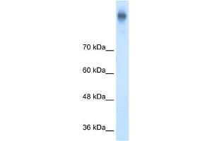 WB Suggested Anti-SLC12A2 Antibody Titration: 5.