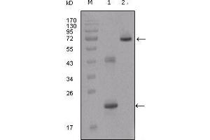 Western blot analysis using IGFBP2 mouse mAb against truncated IGFBP2-His recombinant protein (1) and truncated IGFBP2 (aa40-328)-hIgGFc transfected CHO-K1 cell lysate (2).
