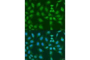 Immunofluorescence analysis of U2OS cells using PHF21B antibody. (PHF21B 抗体  (AA 322-531))
