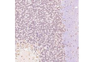 Immunohistochemistry (Paraffin-embedded Sections) (IHC (p)) image for anti-Zinc Finger Protein, FOG Family Member 2 (ZFPM2) antibody (ABIN7076277)