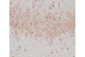 Immunohistochemistry of paraffin-embedded Rat brain using TMX1 Polyclonal Antibody at dilution of 1:100 (40x lens). (TMX1 抗体)