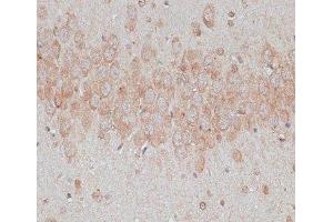 Immunohistochemistry of paraffin-embedded Rat brain using TMX1 Polyclonal Antibody at dilution of 1:100 (40x lens). (TMX1 抗体)