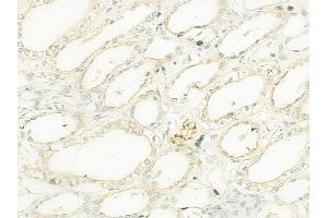 ABIN6261333 and ABIN6273113 at 1/100 staining human normal kidney tissue by IHC-P.
