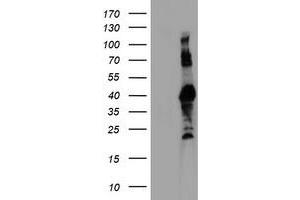 Western Blotting (WB) image for anti-Ring Finger Protein 113B (RNF113B) antibody (ABIN1500715) (RNF113B 抗体)