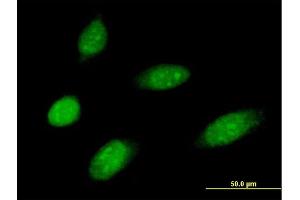 Immunofluorescence of purified MaxPab antibody to MMS19 on HeLa cell. (MMS19 抗体  (AA 1-293))