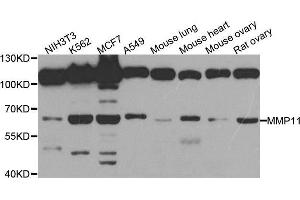 Western blot analysis of extracts of various cell lines, using MMP11 antibody. (MMP11 抗体)