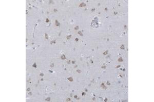 Immunohistochemical staining of human cerebral cortex with CCNJ polyclonal antibody  shows moderate cytoplasmic positivity in neuronal cells. (Cyclin J 抗体)