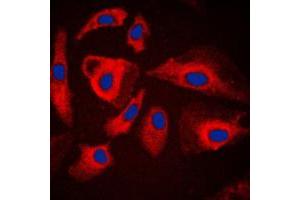 Immunofluorescent analysis of HSPH1 staining in HeLa cells. (HSPH1 抗体  (C-Term))