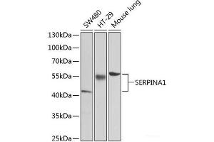 Western blot analysis of extracts of various cell lines using SERPINA1 Polyclonal Antibody at dilution of 1:1000. (SERPINA1 抗体)