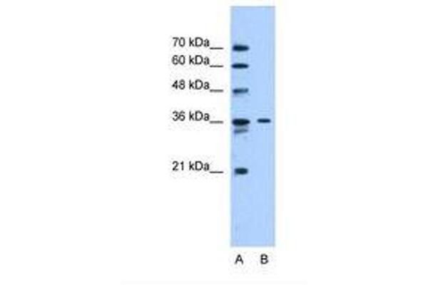 SLC35A3 抗体  (AA 151-200)
