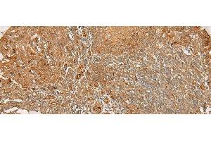 Immunohistochemistry of paraffin-embedded Human tonsil tissue using FLNC Polyclonal Antibody at dilution of 1:30(x200) (FLNC 抗体)