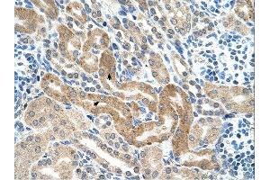 CHAF1B antibody was used for immunohistochemistry at a concentration of 4-8 ug/ml. (CHAF1B 抗体)